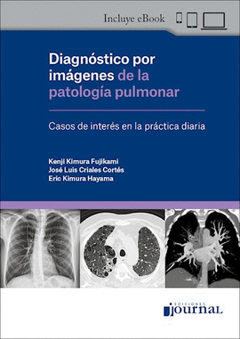 DIAGN�STICO POR IM�GENES DE LA PATOLOG�A PULMONAR