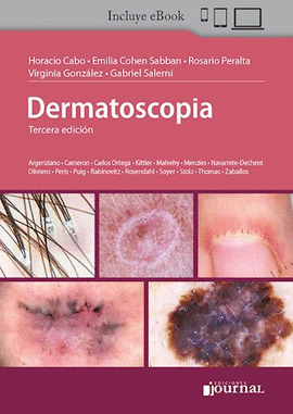 DERMATOSCOPIA