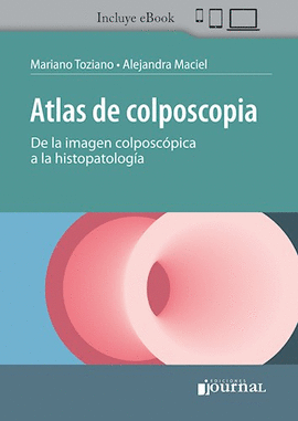 ATLAS DE COLPOSCOPIA